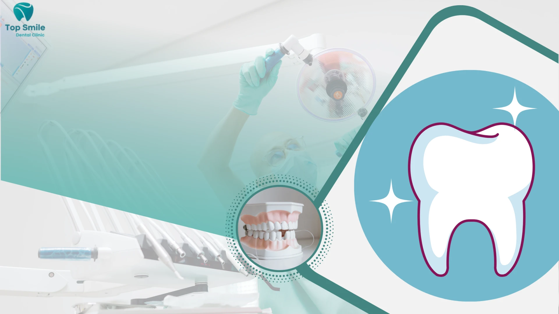 White Smile Dental Clinic: Where Confidence Begins With a Brighter Smile