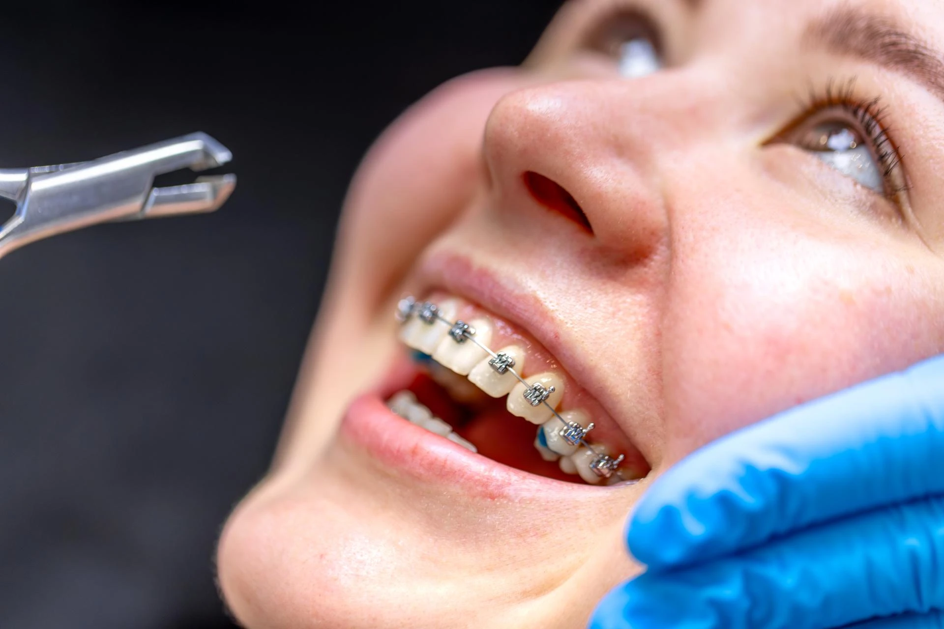 Best Orthodontist in Lucknow – Your Complete Guide to Straighter, Healthier Teeth