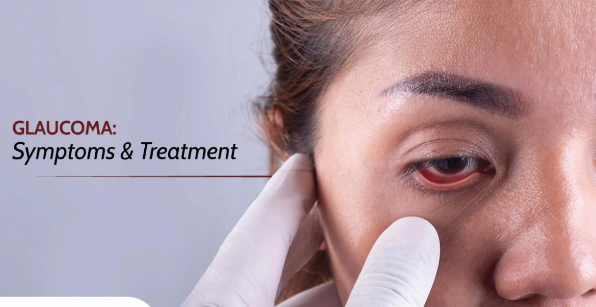 Glaucoma: The Silent Thief of Sight