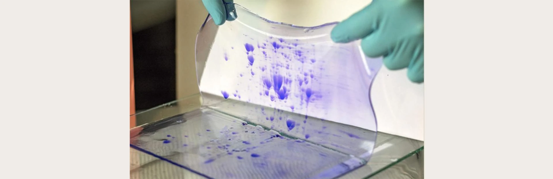 What Is Western Blotting Protein and How Is It Used in Protein Detection?