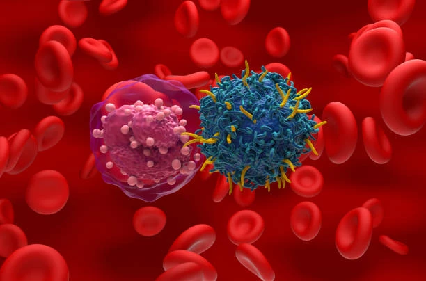 How bad is lymphoma cancer?