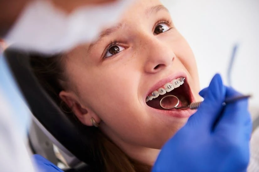 The 2025 Braces Trends Transforming Smiles in Los Angeles