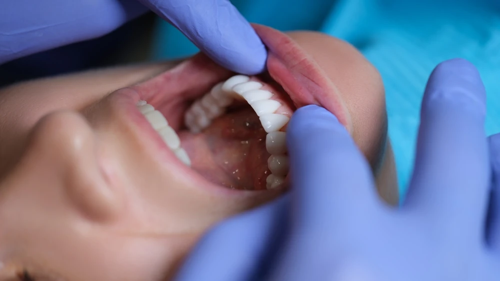 How Oral Rehabilitation Combines Treatments for Full Mouth Restoration in Miami FL