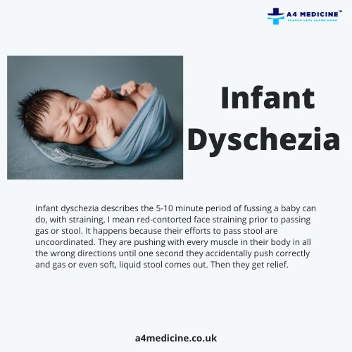 Infant Dyschezia NHS: A Health Problem in Children | A4medicine