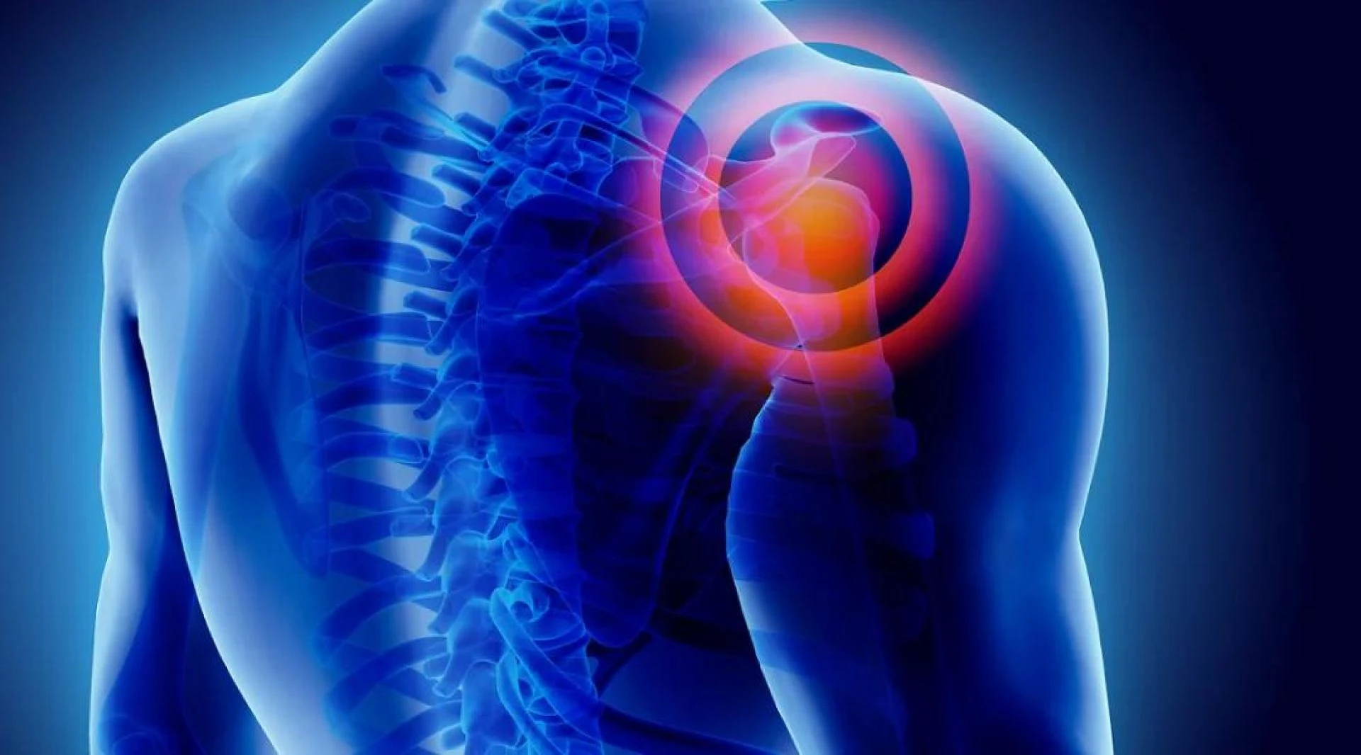 Cortisone Hip Injection Pain Relief Guide