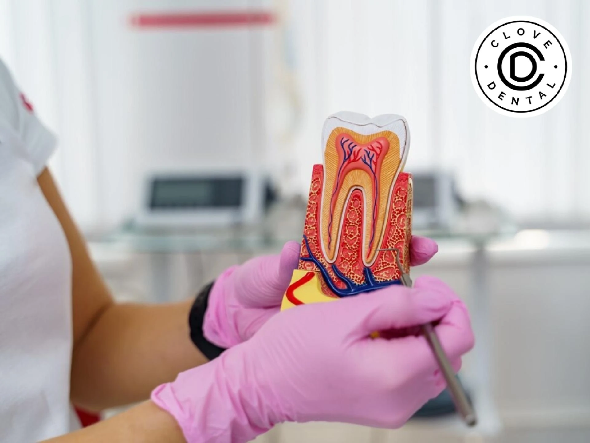 Sherman Oaks Dentist | Explore Safe Root Canal Treatment in CA