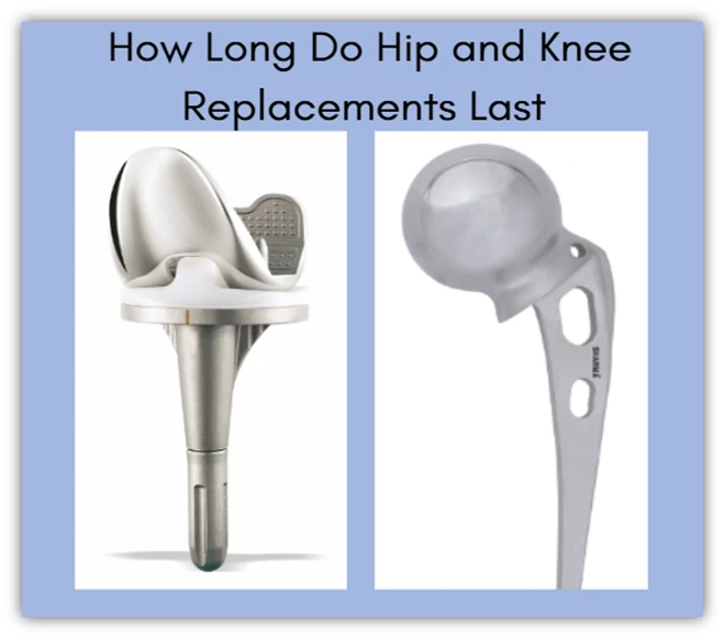 Orthopedic Implant Longevity: How Long Do Hip and Knee Replacements Last?