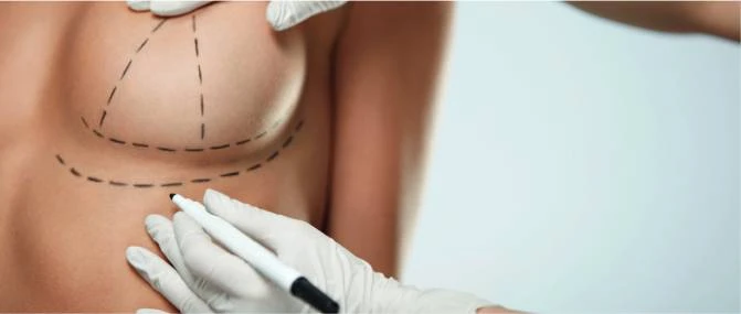 Breast Lift Dubai: Restore a Youthful, Uplifted Contour Naturally