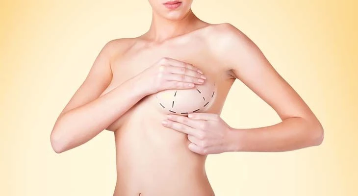 Breast Enlargement: The Impact of Lifestyle, Diet, and Genetics on the Procedure
