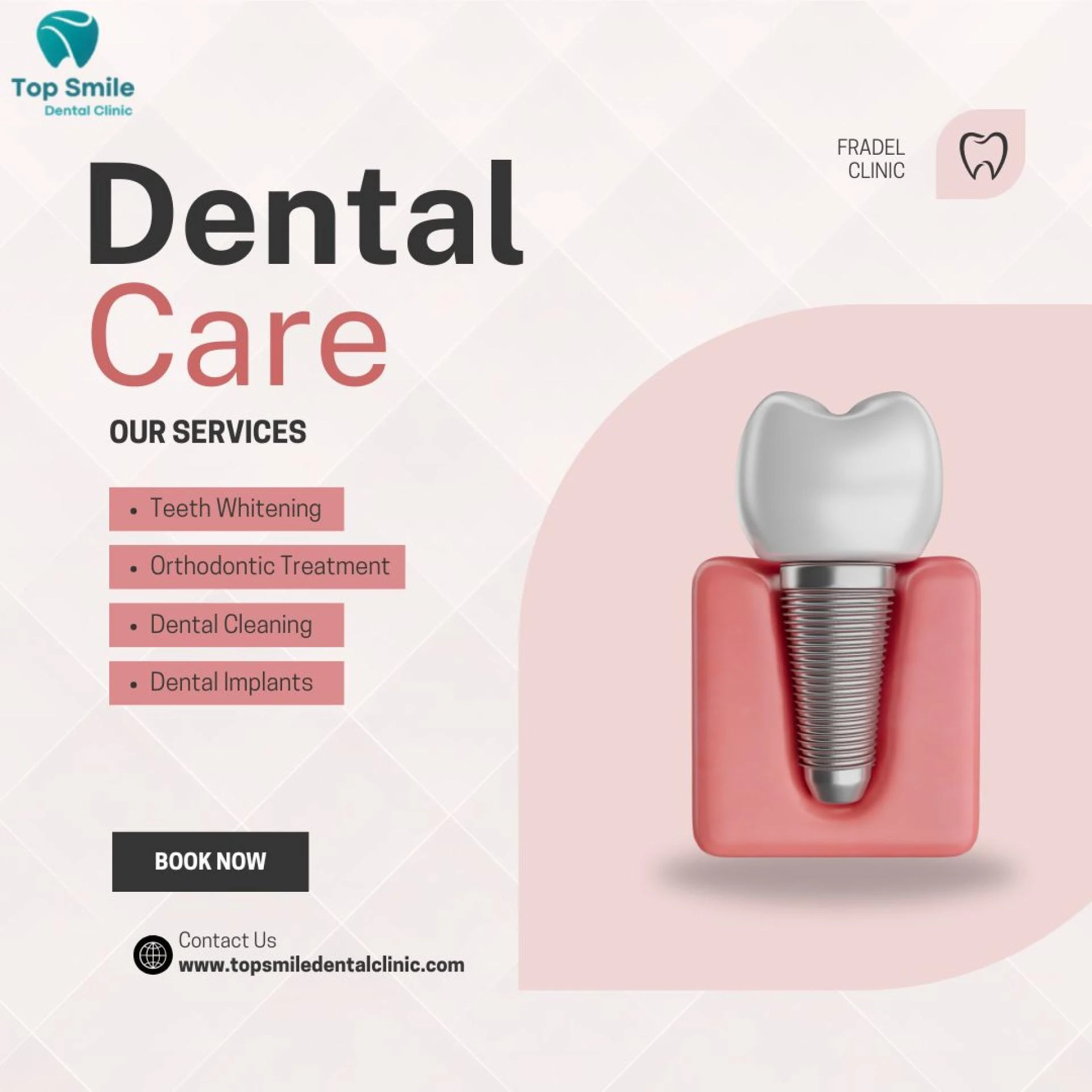 Same Day Dental Implants in Dubai – Get a New Smile in One Visit!