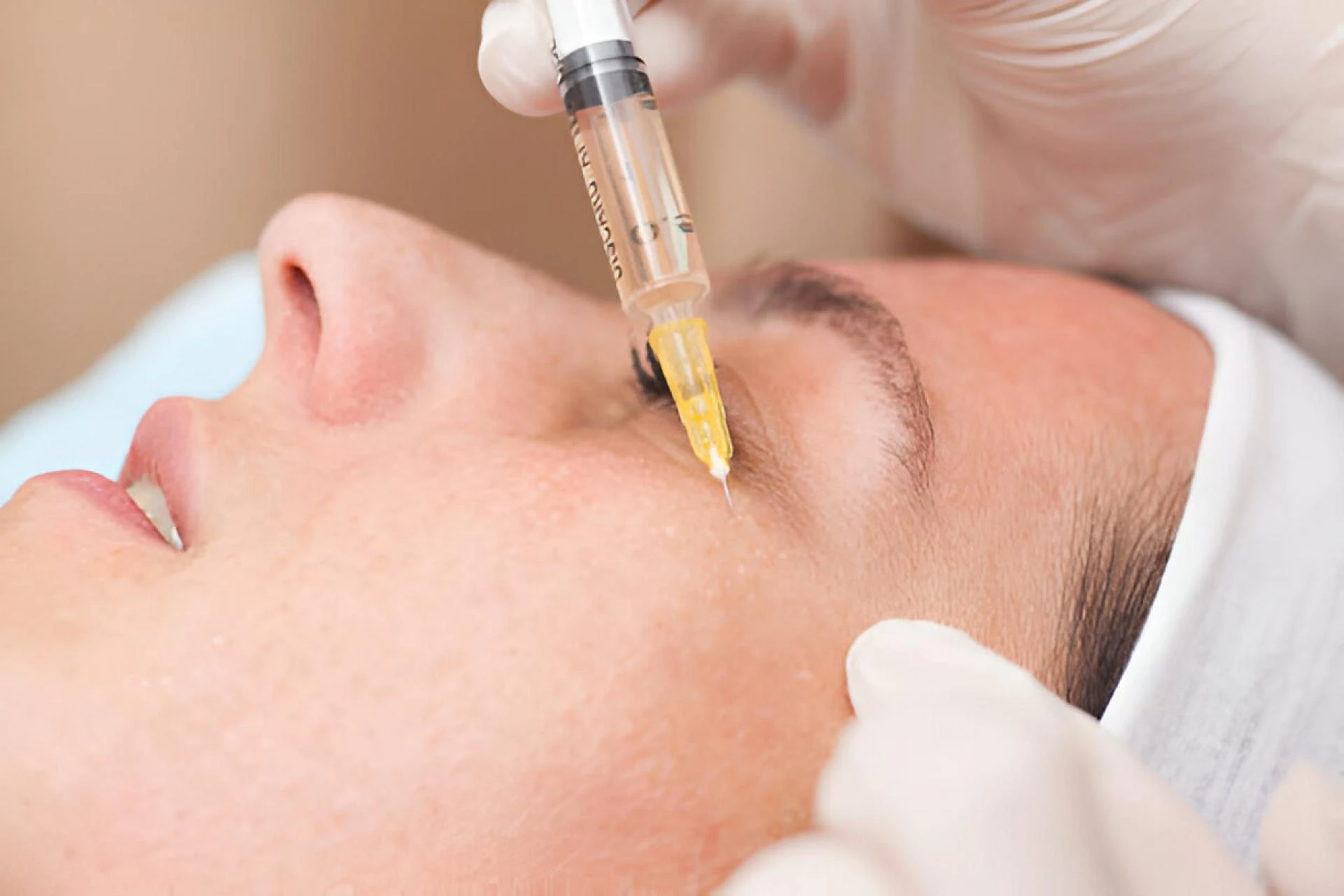 Bright Eyes, Naturally: Why PRP Under Eye Treatment Is Gaining So Much Buzz