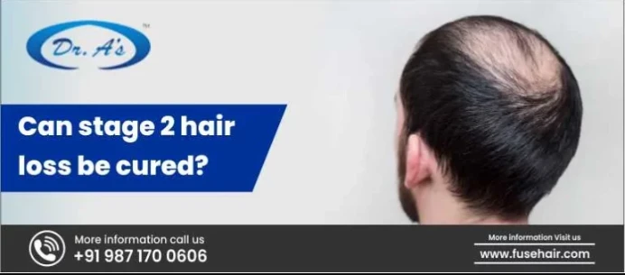Can Stage 2 Hair Loss Be Cured | Best DHT Blocker Foods for Hair Growth