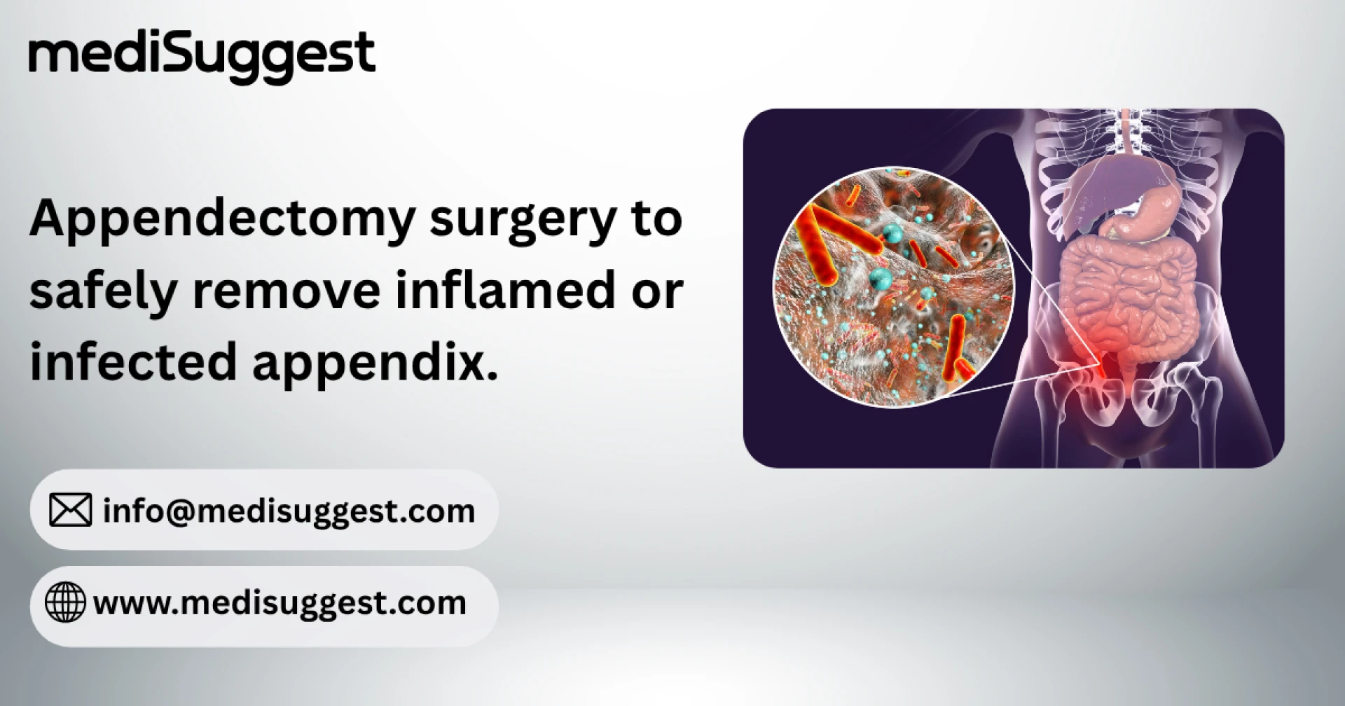 Appendectomy Surgery in Mira Bhayander