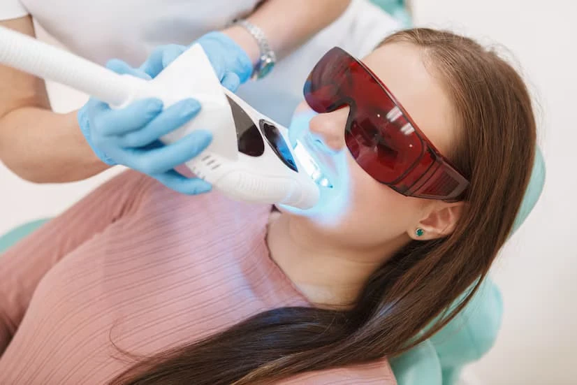 How to Choose the Right Teeth Whitening Dentist for Natural, Lasting Results