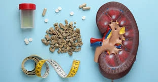 High Oxalate Foods PDF Guide: Download and Start Your Kidney-Friendly Diet