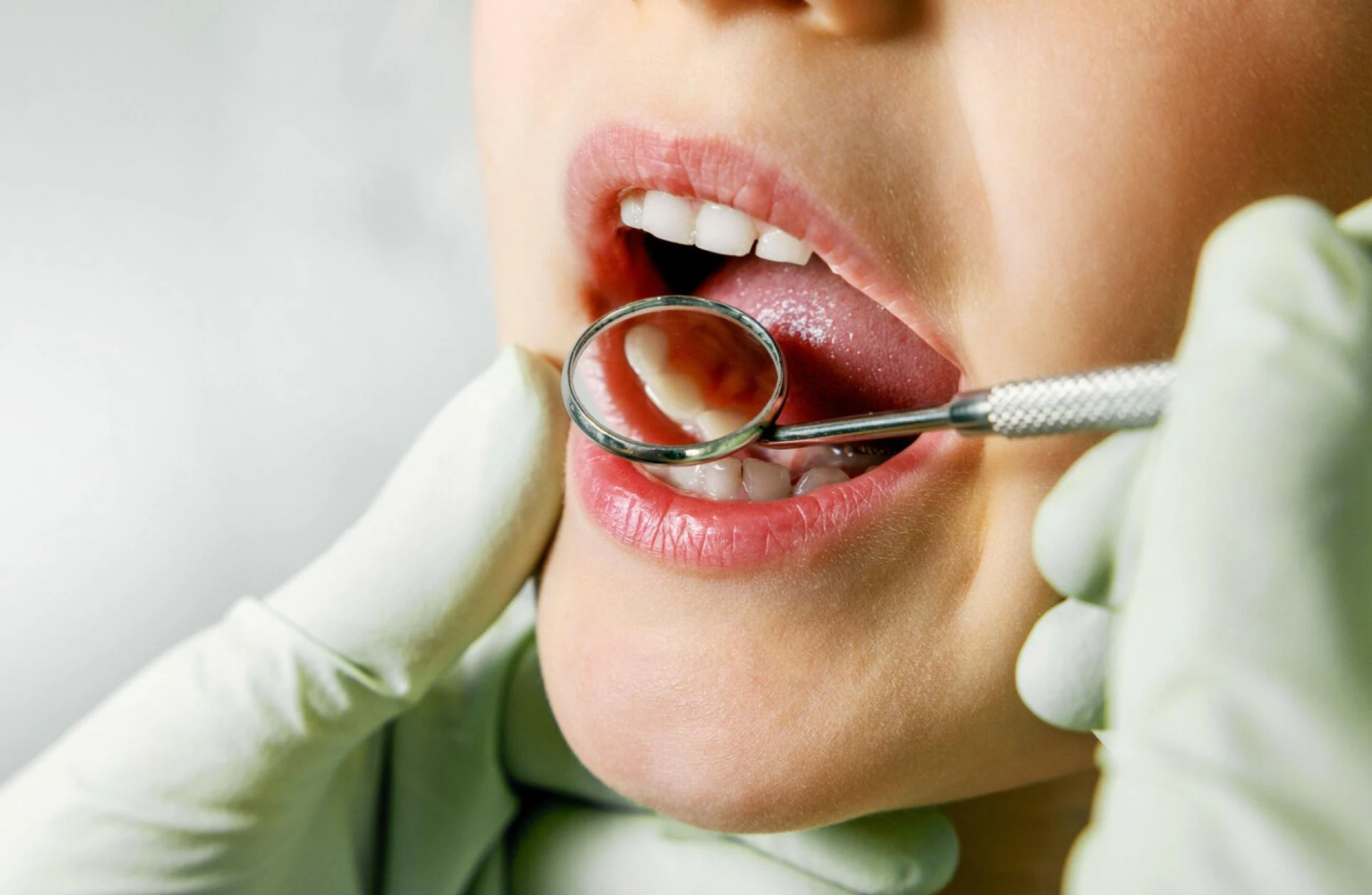 Healthy Smiles, Happy Kids: Your Guide to the Right Pediatric Dentist Near Atlanta