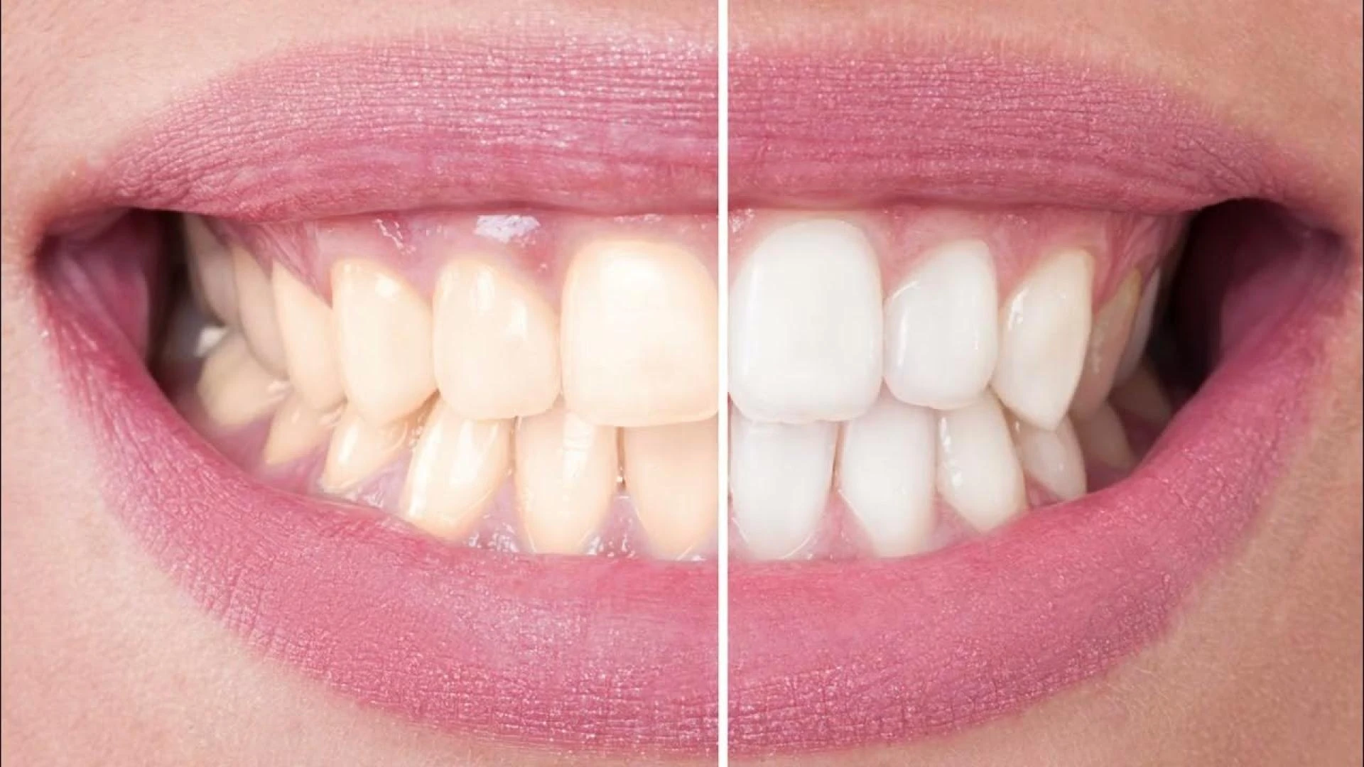 Cosmetic Dentistry: Simple Solutions for a Better Smile