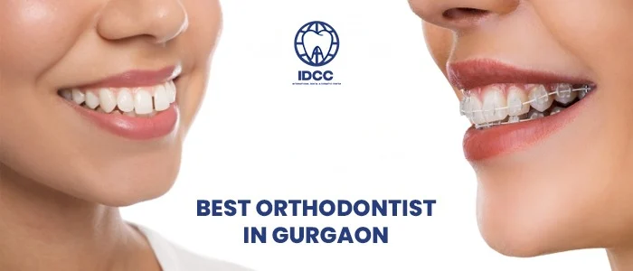 Best Orthodontist in Gurgaon: Everything You Need to Know Before Choosing