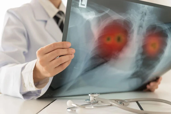 Chronic Cough and Increasing Shortness of Breath Care in Glendale, CA