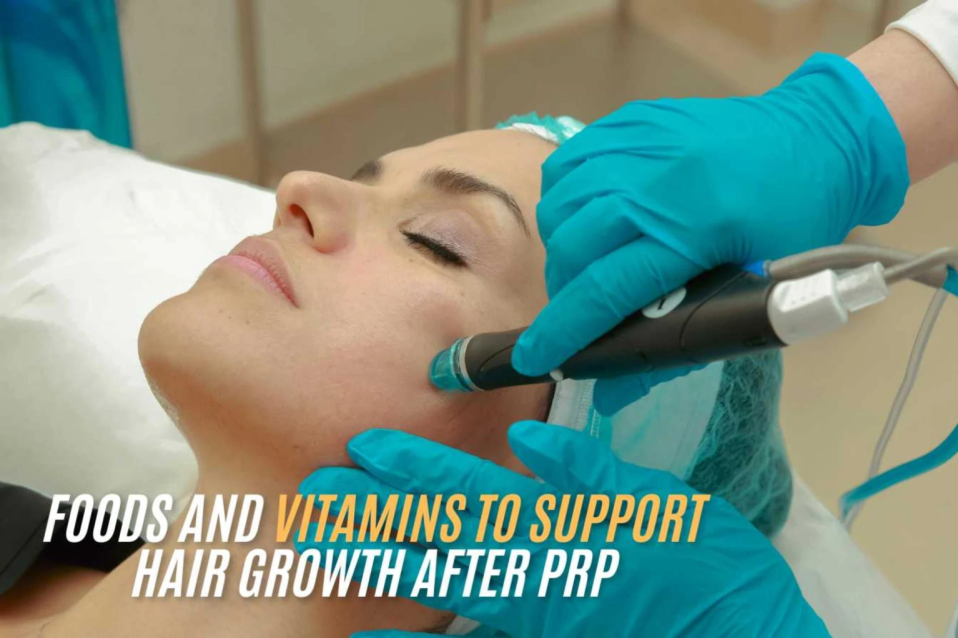 The Do’s and Don’ts Before Getting Lip Fillers