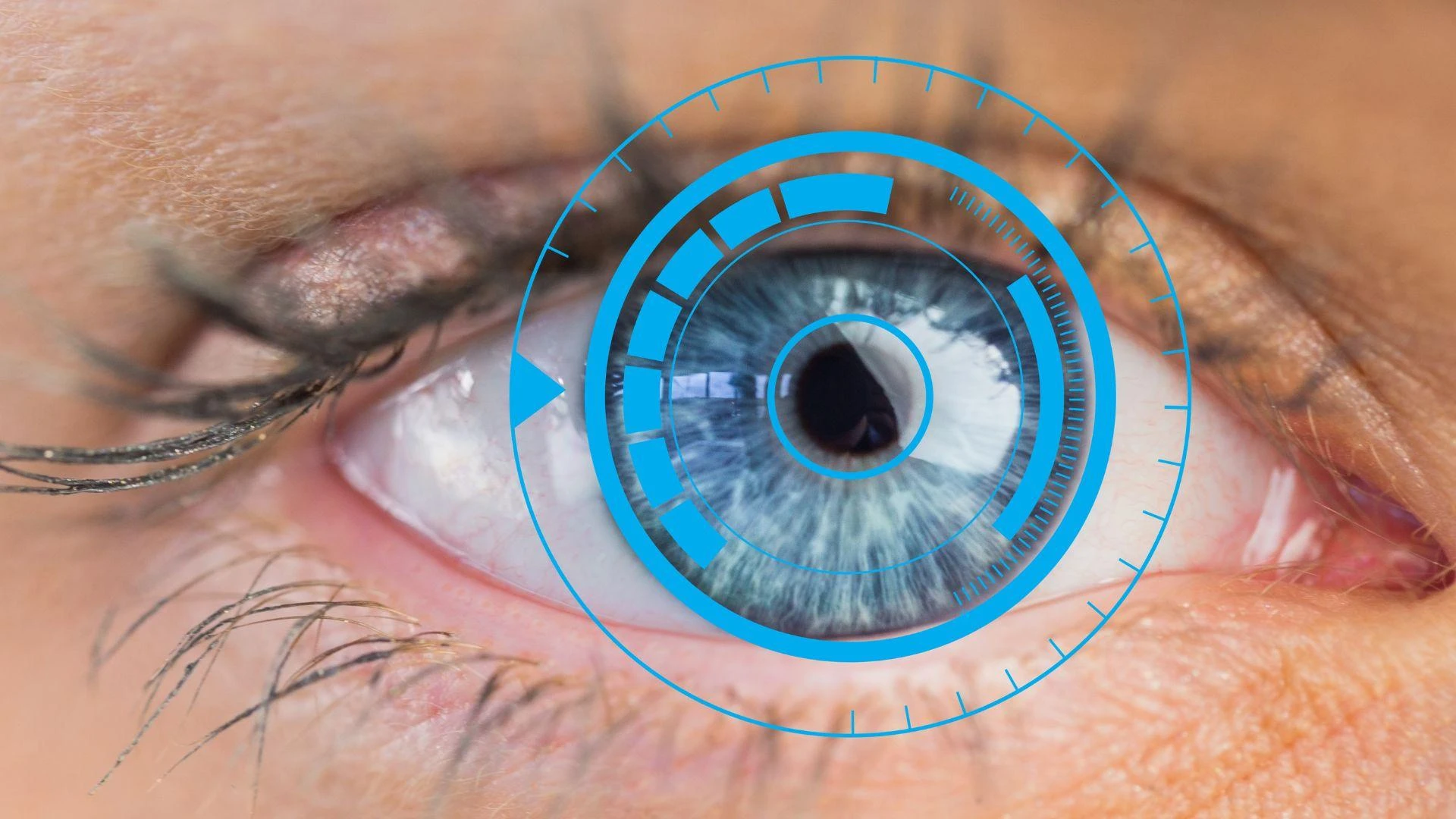 Find Quality and Affordability with Top Lasik Eye Care in Mauritius