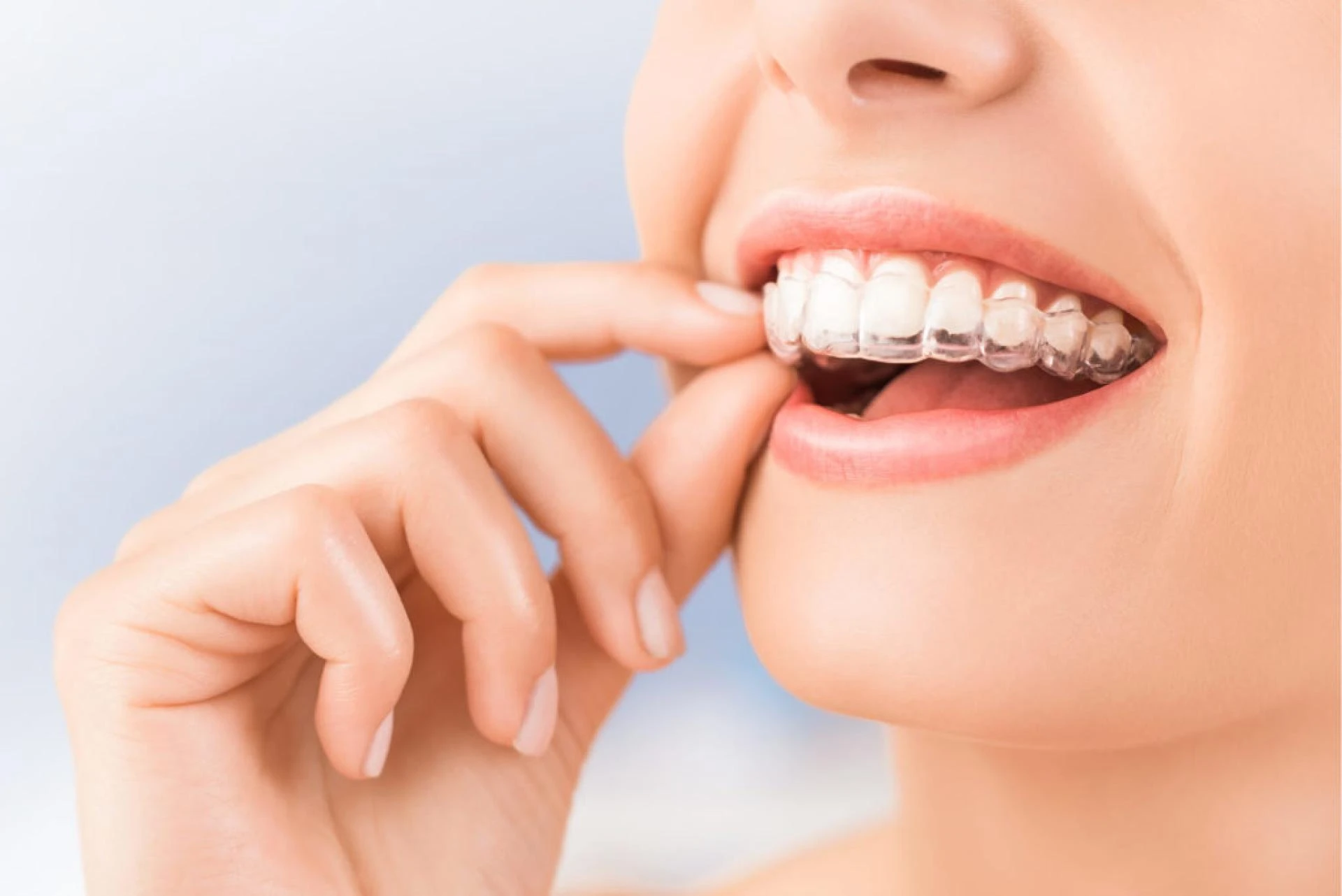 Laser Oral Appliance Therapy – A Modern Solution for Better Oral Health and Sleep