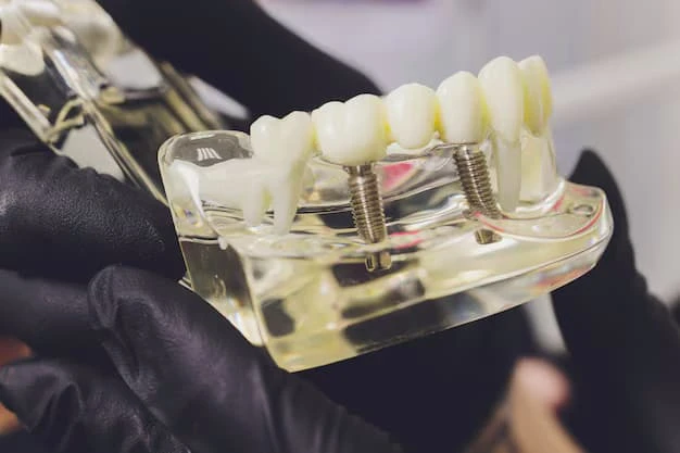 Teeth Implants Birmingham: Your Guide to Restoring Smiles