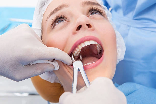 Top 5 Myths About Tooth Extraction in Tampa—Busted!