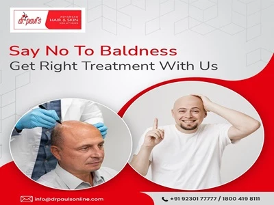 Your Ultimate Guide to the Best Hair Transplant Clinic in Kolkata