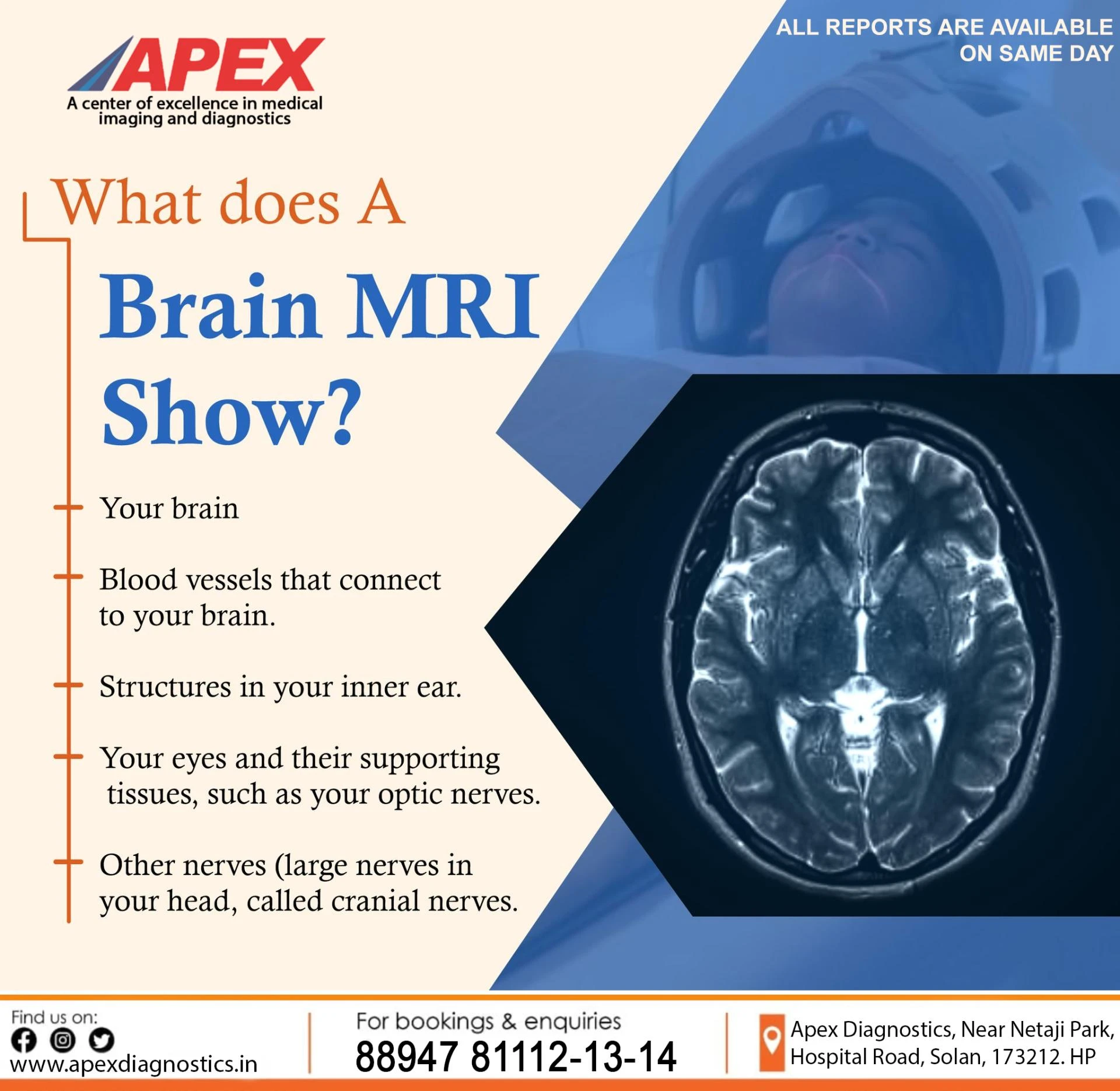 Comprehensive Guide to MRI Angiography in Himachal Pradesh