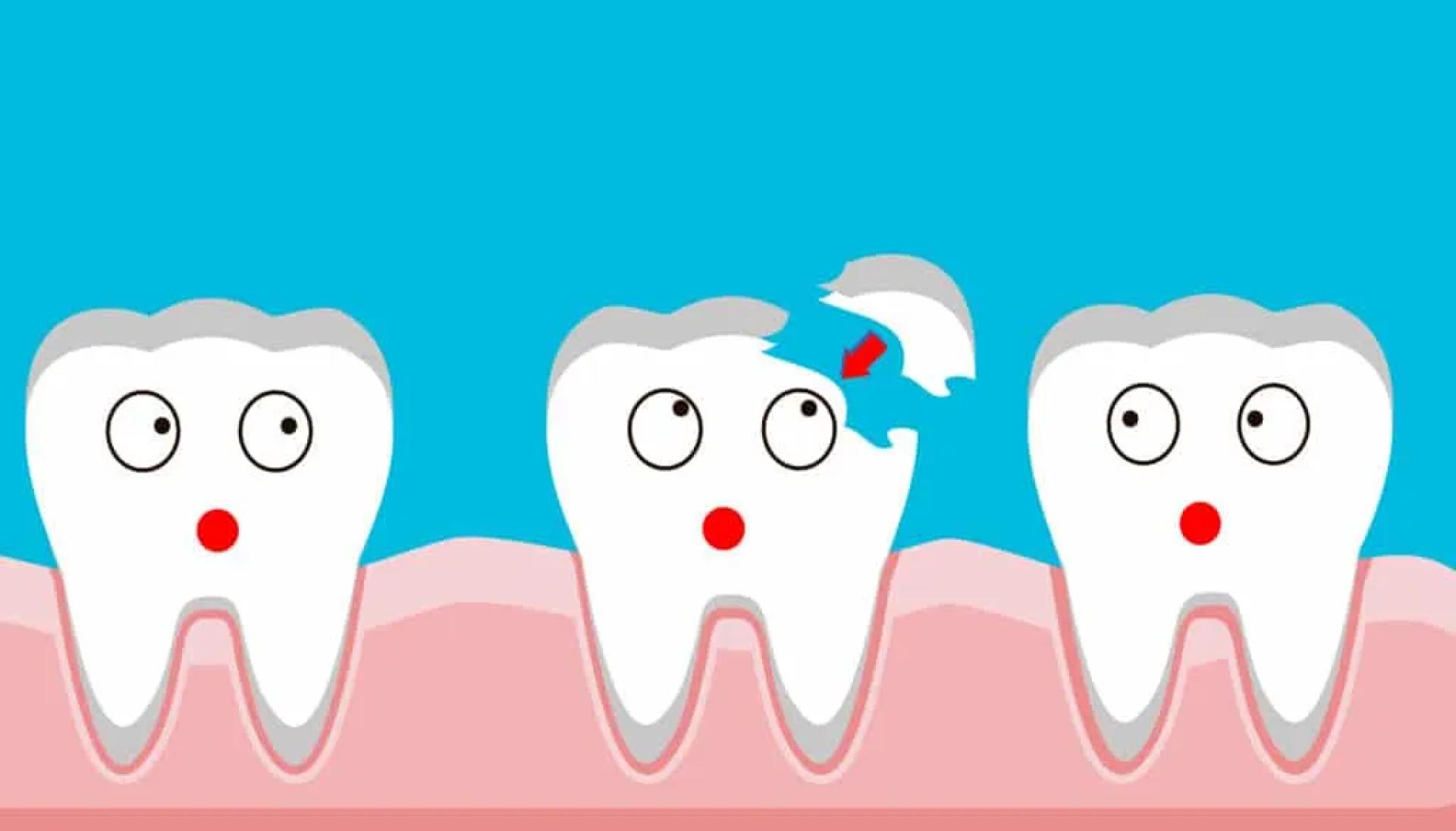 Chipped a Tooth? Here’s How Emergency Dental Care Can Help