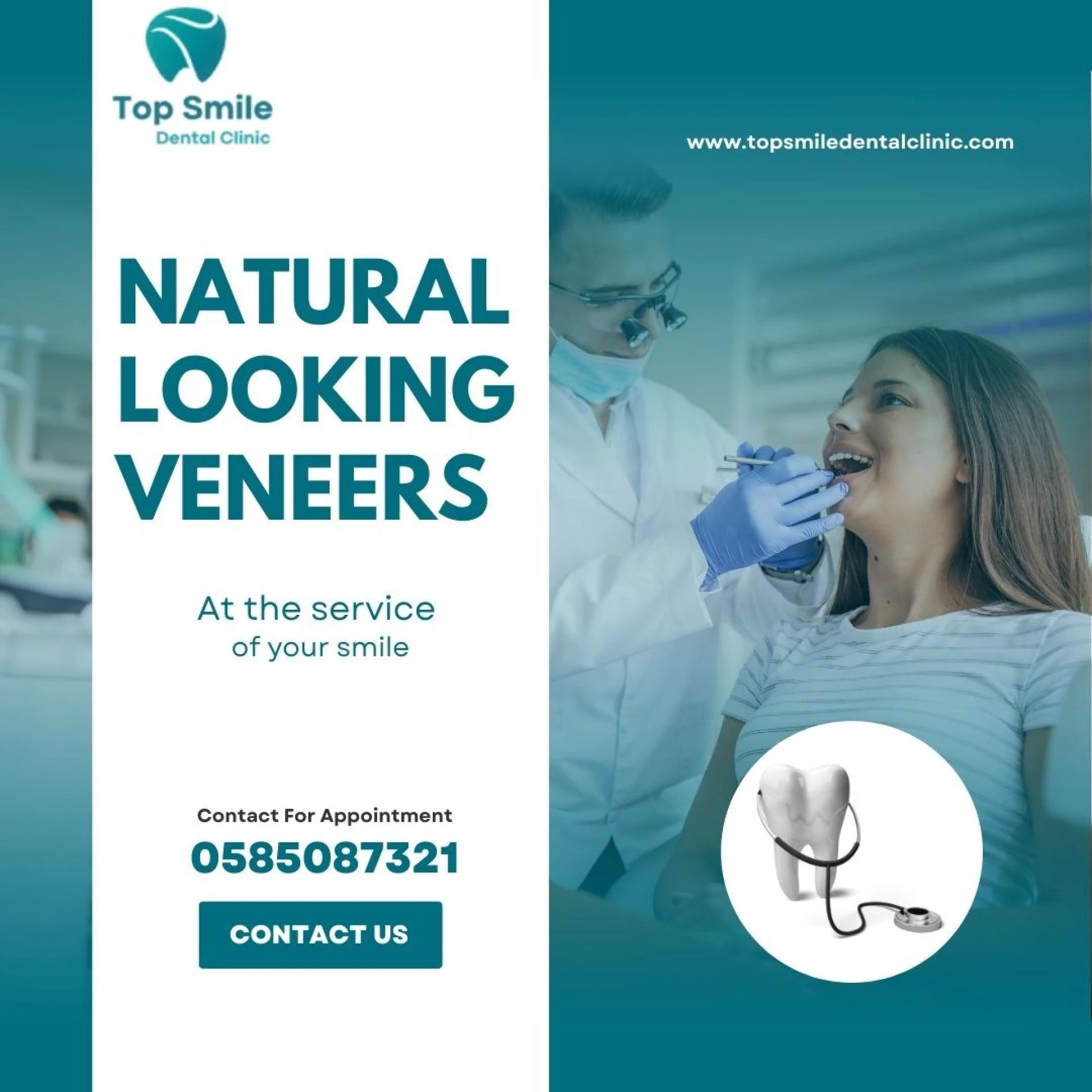 Get Natural Looking Veneers in Dubai – Top Smile Dental Clinic