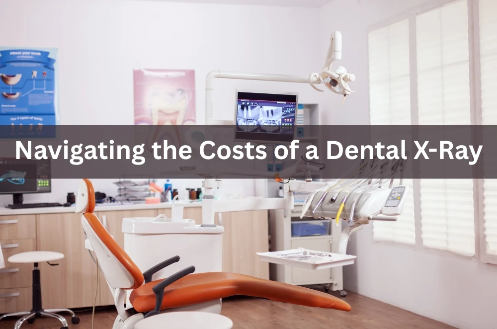 Navigating the Costs of a Dental X-Ray