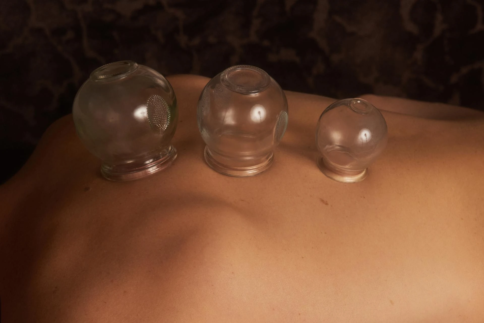 Restore balance and wellness at a leading acupuncture Vancouver clinic