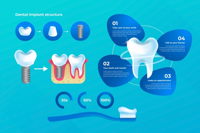 Dental Implant Treatment vs Root Canal Surgery: A Complete Guide