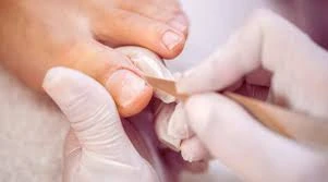 Top Solutions for Toenail Fungus and Foot Care Houston