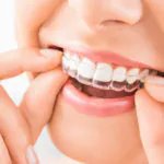 Invisalign Vs. Braces: Which is the Best Option for You?