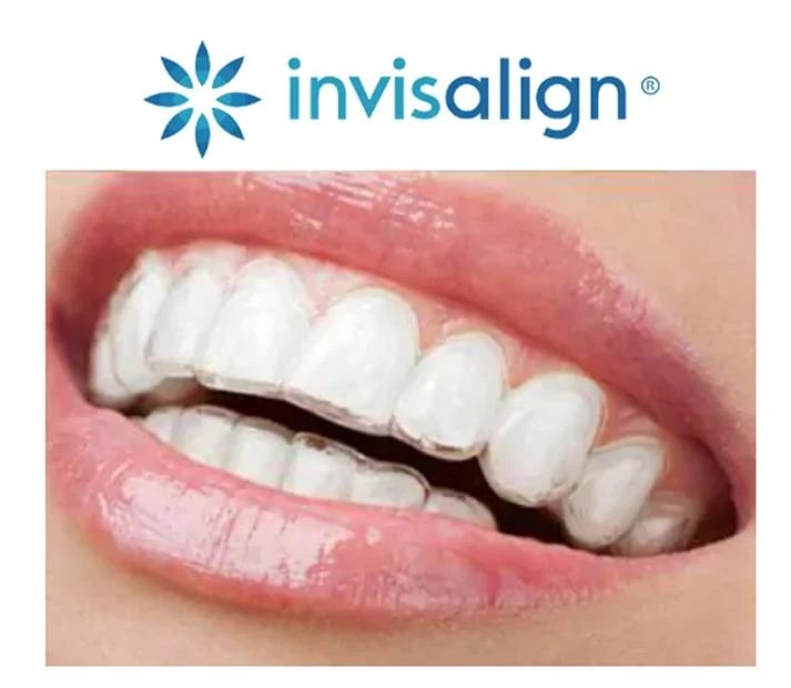 Debunking Common Misconceptions About Teeth Whitening Treatments in Lethbridge