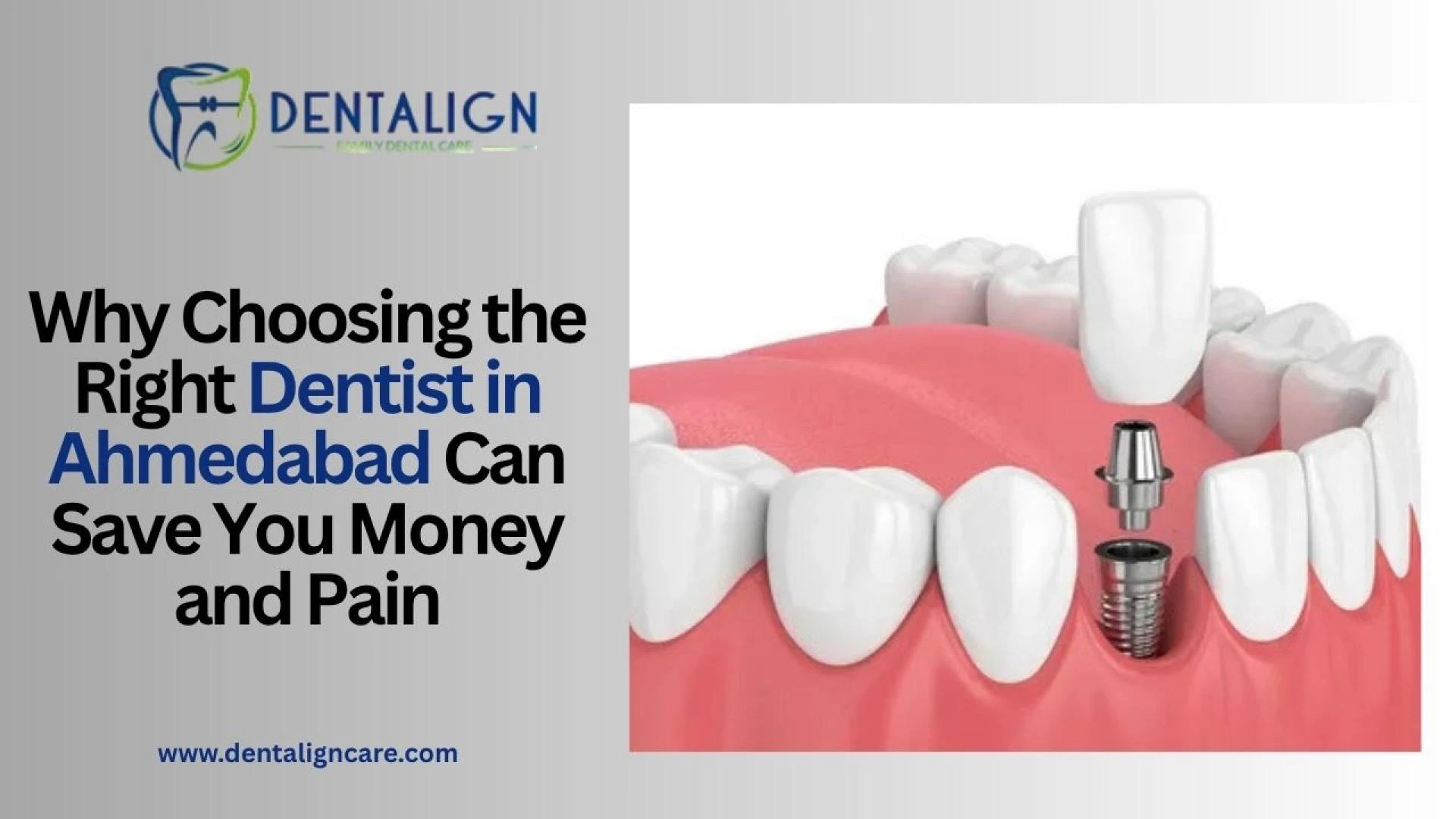 Why Choosing the Right Dentist in Ahmedabad Can Save You Money and Pain