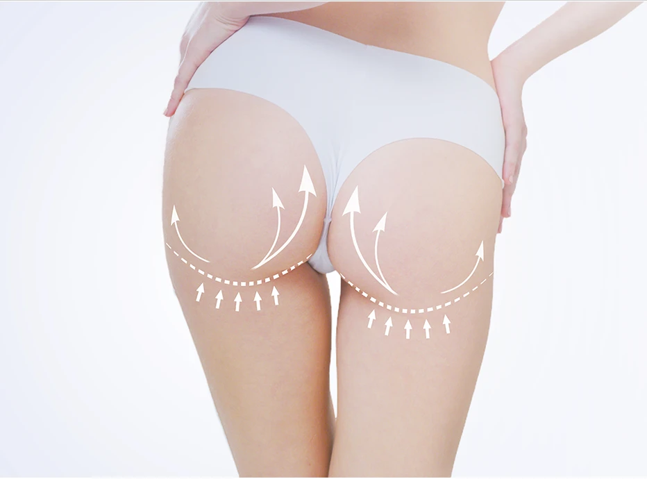 What is Brazilian Butt Lift Techniques?