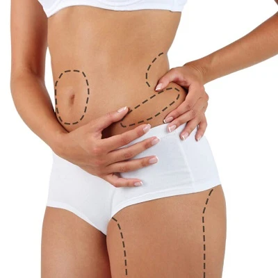 Liposuction Explained: Benefits, Risks & Results