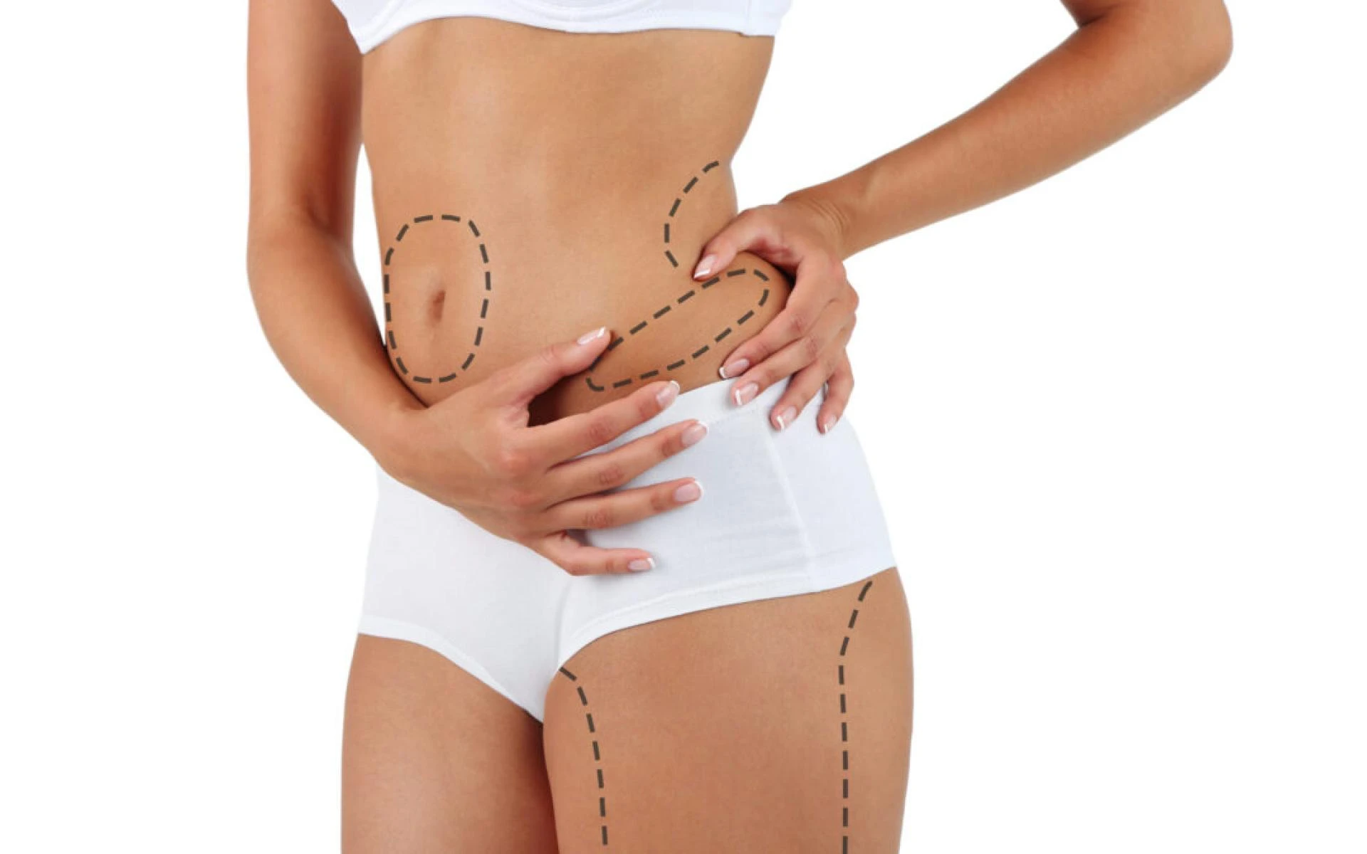 Can Liposuction Be Combined with Other Cosmetic Procedures