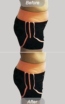 Build Muscle and Lose Fat Treatment Solution with Magshape