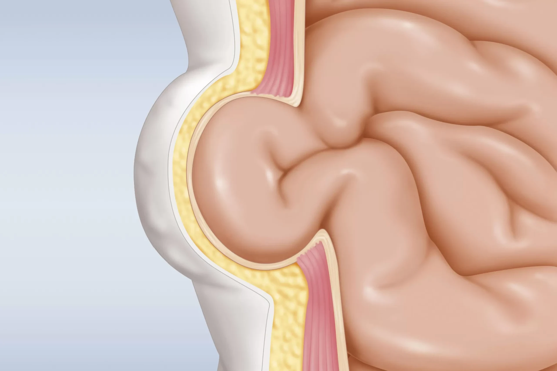 How to Choose the Best Hernia Surgery Hospital for a Safe Recovery?