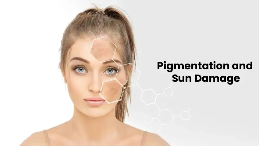 Pigmentation and Sun Damage Treatment: All You Need to Know