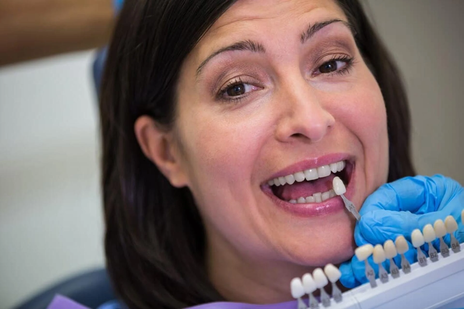 How Dental Veneers in Oxnard Can Boost Your Confidence