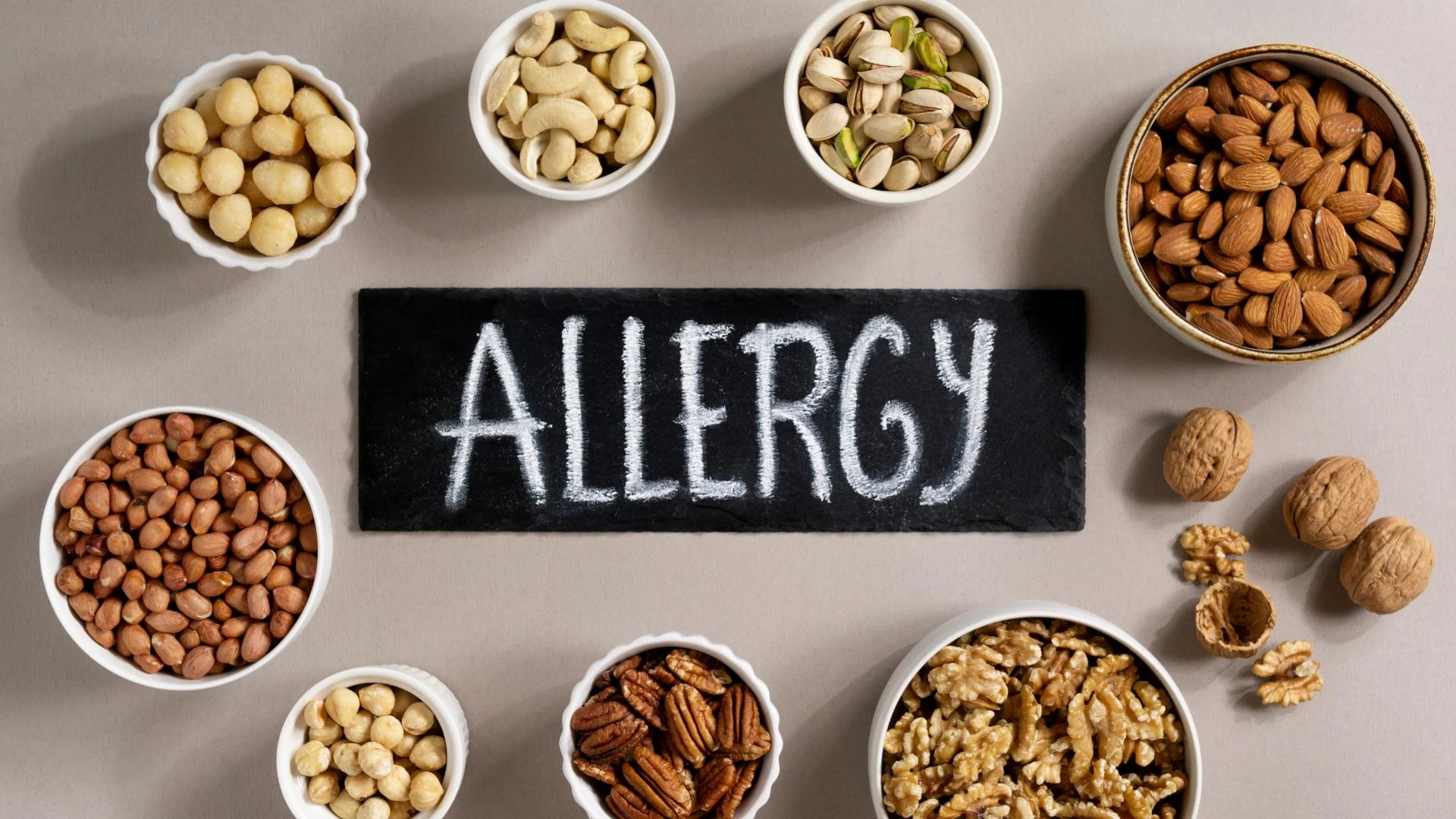 Food Allergy Treatment and Management Options