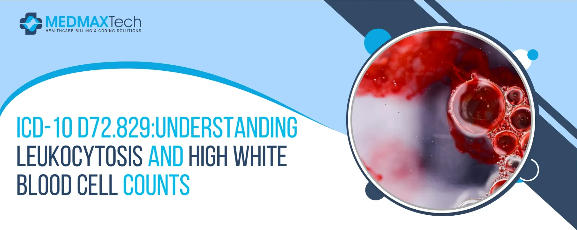 ICD-10 D72.829: Leukocytosis & Elevated WBC Overview