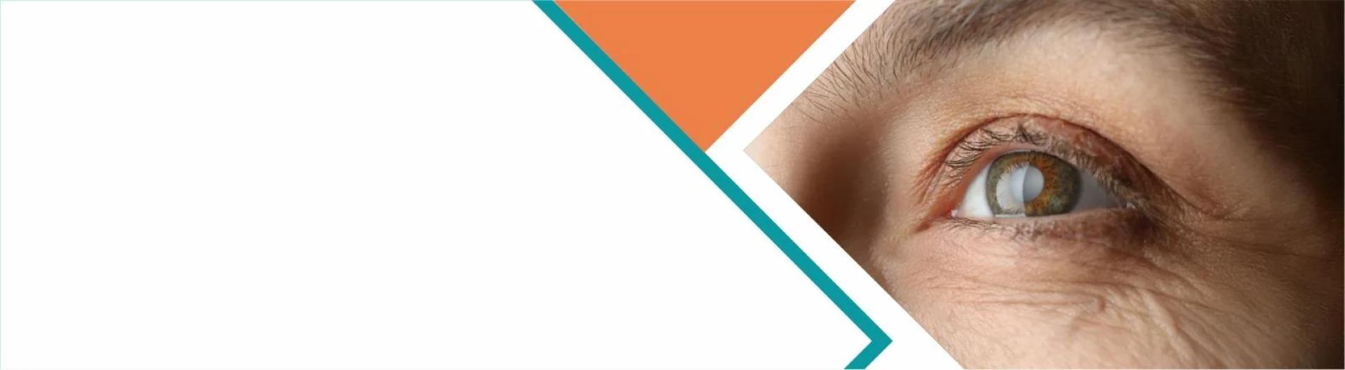 Cataract Surgery in Mauritius: What to Know and How Spectra Eye Hospital Helps You See Better 