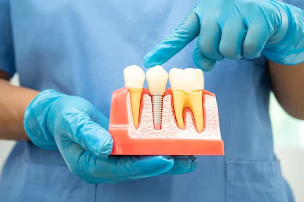 What to Expect When Getting Dental Implants Near Me